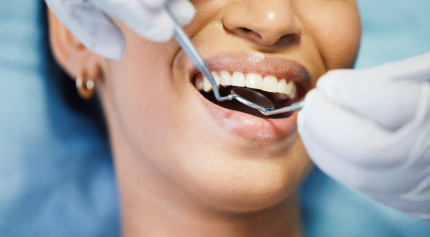 Best Walk-In Emergency Dental Services in Fair Oaks, GA